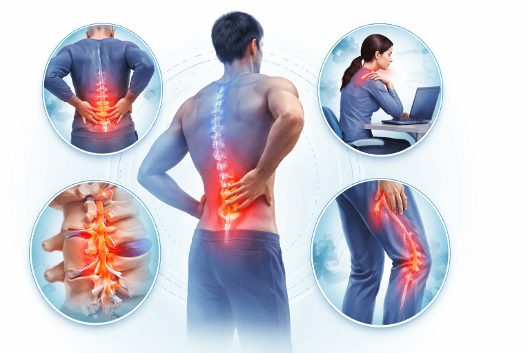 Back Pain Treatment in Ahmedabad