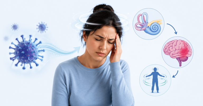 Post Viral Dizziness Physiotherapy