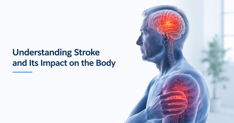 Early Stroke Rehabilitation