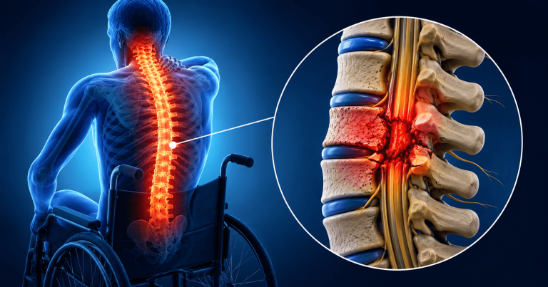 Spinal Cord Injury Recovery Process